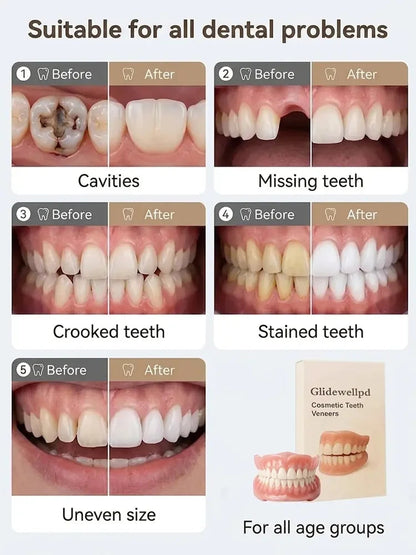 Ends Today: 76% OFF! 🦷[Epic Upgrade] Premium Full Cover Dentures🦷