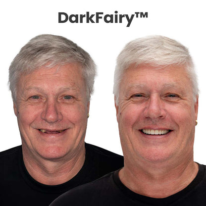 🏆🏆Ends Today: 50% OFF! 🏆2026 Bestselling Product🦷 Fit for a Fresh Smile, Say Goodbye to Wearing Discomfort!