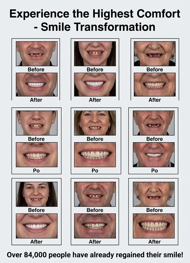 🏆🏆Ends Today: 50% OFF! 🏆2026 Bestselling Product🦷 Fit for a Fresh Smile, Say Goodbye to Wearing Discomfort!