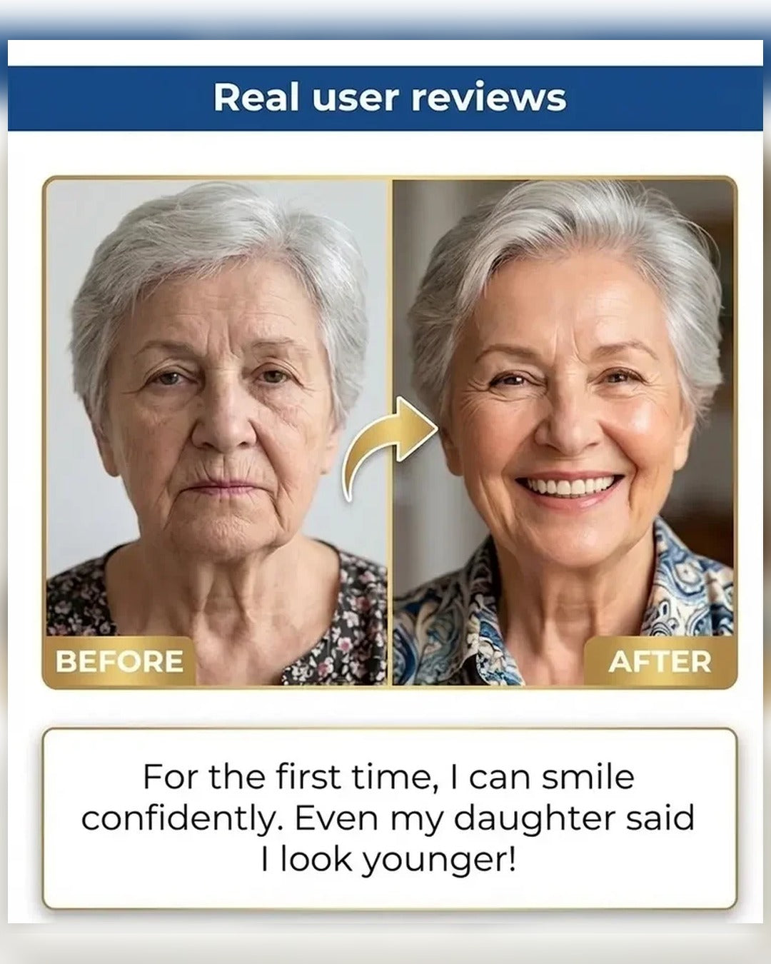 🏆🏆Ends Today: 50% OFF! 🏆2026 Bestselling Product🦷 Fit for a Fresh Smile, Say Goodbye to Wearing Discomfort!