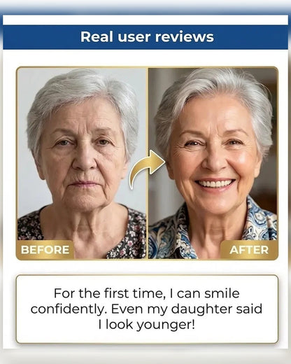 🏆🏆Ends Today: 50% OFF! 🏆2026 Bestselling Product🦷 Fit for a Fresh Smile, Say Goodbye to Wearing Discomfort!
